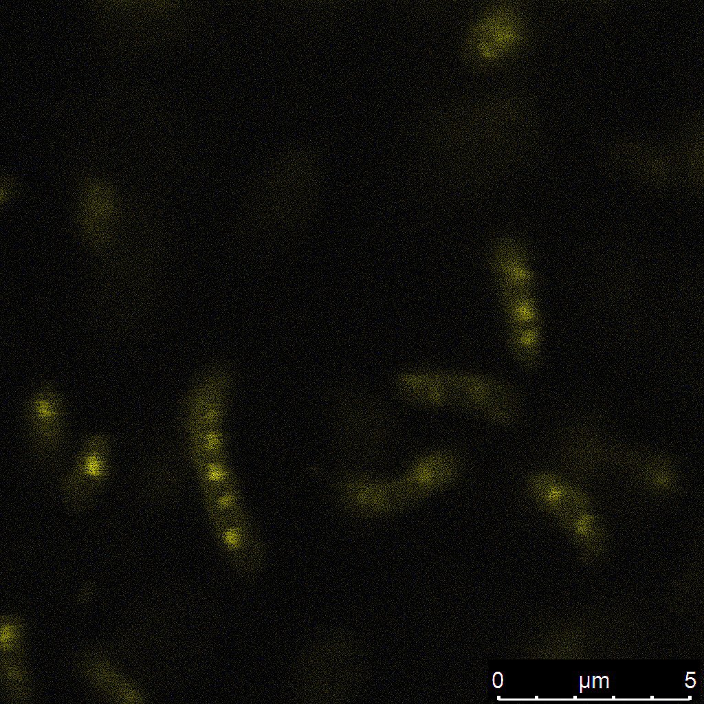 Sphingobium: Nannochloropsis’s quiet bestie. Promotes algae growth, breaks down dioxins and aromatics, now even makes bioplastics (PHA). What more could you want to save the world? Sadly, it’s too silent, growing too slow — and this is a bioproduction mission.