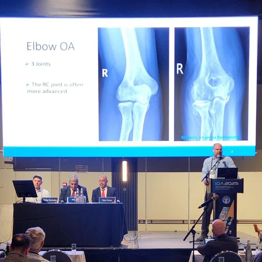 danirotman's tweet photo. Honored to present at the 2025 Israeli Orthopedic Association Conference on a new surgical treatment option radiocapitellar arthritis.  Excited for future collaborations! #Orthopedics #IOA2025 https://t.co/0xn8iuJV1Z