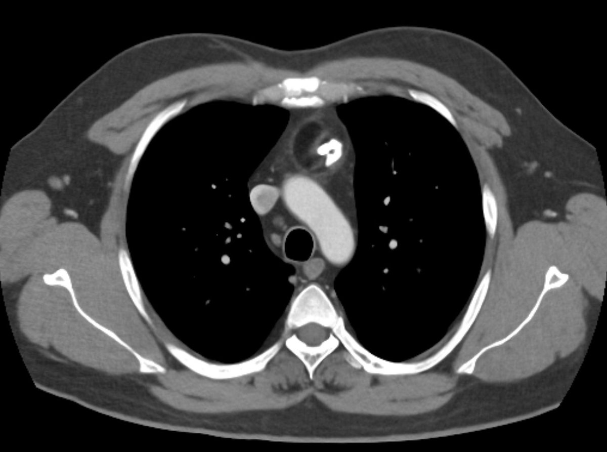 Peder E. Horner, MD Interventional Physician tweet media