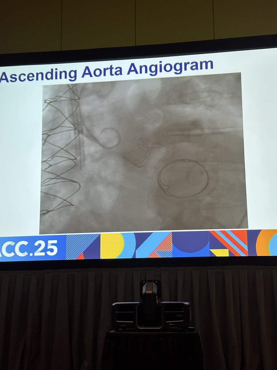 Atrium Health Sanger Heart & Vascular Institute (@atriumshvi) on Twitter photo From severe AI to mitral stenosis and pulmonary hypertension, interpreting invasive hemodynamics is critical for guiding interventions like TAVR, TMVR, and redo surgery. Expert insights at #ACC25! From severe AI to mitral stenosis and pulmonary hypertension, interpreting invasive hemodynamics is critical for guiding interventions like TAVR, TMVR, and redo surgery. Expert insights at #ACC25!