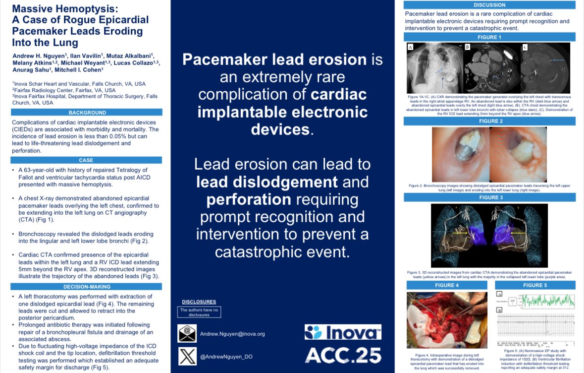 Andrew H. Nguyen, DO (@andrewnguyen_do) on Twitter photo Massive hemoptysis due to eroded pacemaker leads into the lung 🫁🩸 Presented at #ACC25 Moderated Digital Poster Sessions. 🫀📣
Thanks to my mentors and colleagues <a href="/ilanvavilinmd/">Ilan Vavilin</a> @mutazalkalbani <a href="/InovaCVfellows/">InovaCVfellows</a> <a href="/ISHVnews/">Inova Schar Heart and Vascular</a> <a href="/ACCinTouch/">American College of Cardiology</a> <a href="/ShashankSinhaMD/">Shashank Sinha, MD, MSc, FACC, FAHA, FHFSA</a> Massive hemoptysis due to eroded pacemaker leads into the lung 🫁🩸 Presented at #ACC25 Moderated Digital Poster Sessions. 🫀📣
Thanks to my mentors and colleagues <a href="/ilanvavilinmd/">Ilan Vavilin</a> @mutazalkalbani <a href="/InovaCVfellows/">InovaCVfellows</a> <a href="/ISHVnews/">Inova Schar Heart and Vascular</a> <a href="/ACCinTouch/">American College of Cardiology</a> <a href="/ShashankSinhaMD/">Shashank Sinha, MD, MSc, FACC, FAHA, FHFSA</a>
