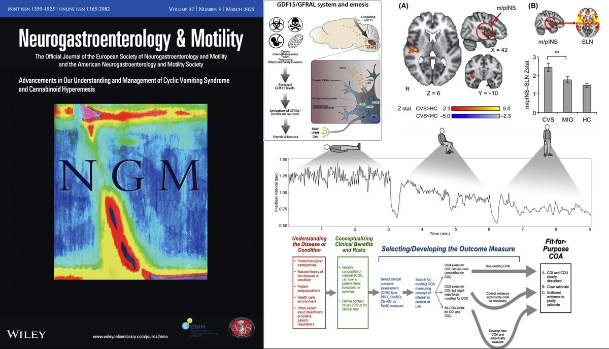 Neurogastro & Motil (@ngmjournal) on Twitter photo 🚨Be sure to check out March 2025 issue‼️
✅Dive deep into the latest research🆕🔥
📢onlinelibrary.wiley.com/toc/13652982/c…
<a href="/maura_corsetti/">maura corsetti</a> <a href="/IBS_Maastricht/">Daniel Keszthelyi MD PhD RFF</a> #FrankZerbib #KBrowning <a href="/DrCJBlack/">Chris Black</a> <a href="/AndreaShin_GI/">Andrea Shin</a> <a href="/mpj61/">Michael Jones</a> <a href="/nicolascenac/">nicolasc</a>
<a href="/ThisIsButt/">Mohsin Butt</a> <a href="/Pierfra_Visaggi/">Pierfrancesco Visaggi, MD</a> <a href="/Rajan___Singh/">Rajan Singh</a> <a href="/ANMSociety/">ANMS</a> <a href="/esnm_eu/">ESNM.eu</a>👏 🚨Be sure to check out March 2025 issue‼️
✅Dive deep into the latest research🆕🔥
📢onlinelibrary.wiley.com/toc/13652982/c…
<a href="/maura_corsetti/">maura corsetti</a> <a href="/IBS_Maastricht/">Daniel Keszthelyi MD PhD RFF</a> #FrankZerbib #KBrowning <a href="/DrCJBlack/">Chris Black</a> <a href="/AndreaShin_GI/">Andrea Shin</a> <a href="/mpj61/">Michael Jones</a> <a href="/nicolascenac/">nicolasc</a>
<a href="/ThisIsButt/">Mohsin Butt</a> <a href="/Pierfra_Visaggi/">Pierfrancesco Visaggi, MD</a> <a href="/Rajan___Singh/">Rajan Singh</a> <a href="/ANMSociety/">ANMS</a> <a href="/esnm_eu/">ESNM.eu</a>👏