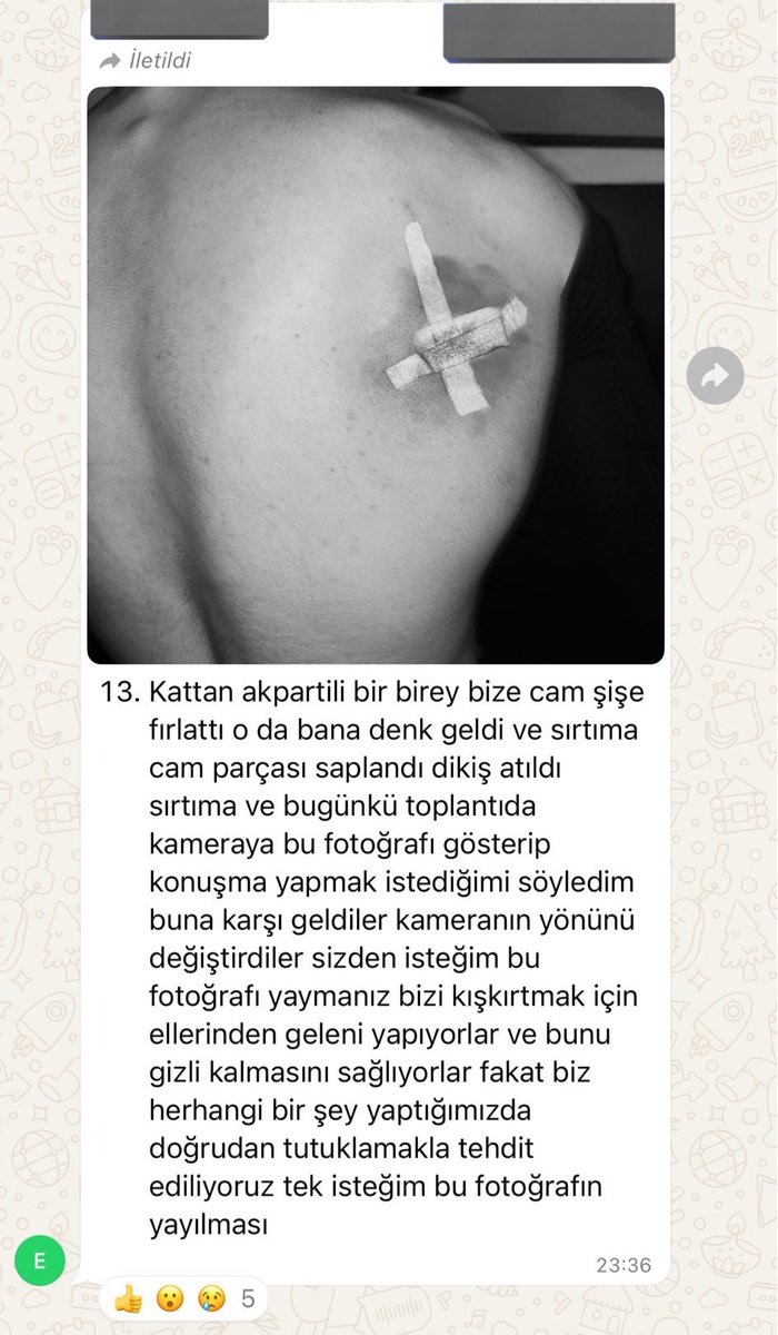 abi bu kacinci seviye amina koyim ya