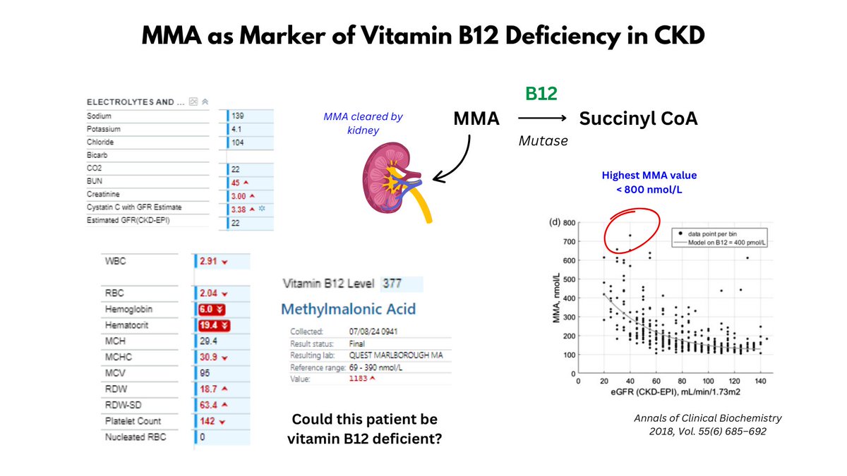 1/2

MMA, B12 DEFICIENCY AND CKD

I was on consult service last week and saw a patient with pancytopenia and the labs shown in the graphic.

Based on the elevated MMA, I worried about B12 deficiency, but one of my trainees pointed out that MMA is increased in patients with CKD.