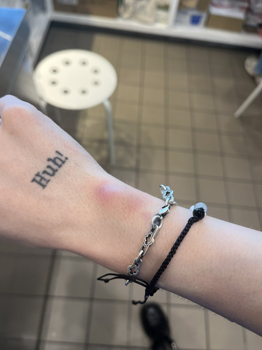 i’ve been getting so many bruises idk HOW