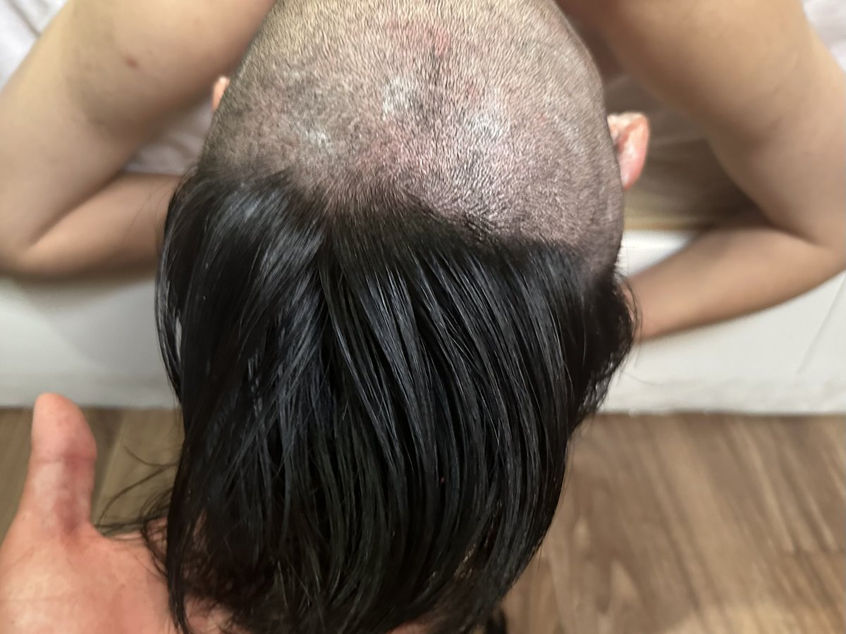 这个长度直接剃很爽😏