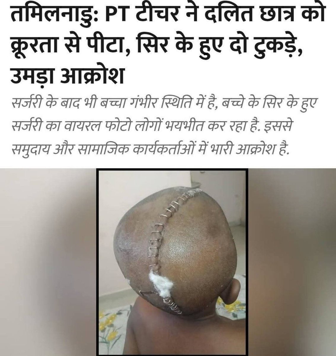 nitinmeshram_'s tweet image. DMK इस देश की सबसे जातिवादी पार्टियों में से एक है। हमें डिएमके की सरकार को उखाड़ फेंकना चाहिए।