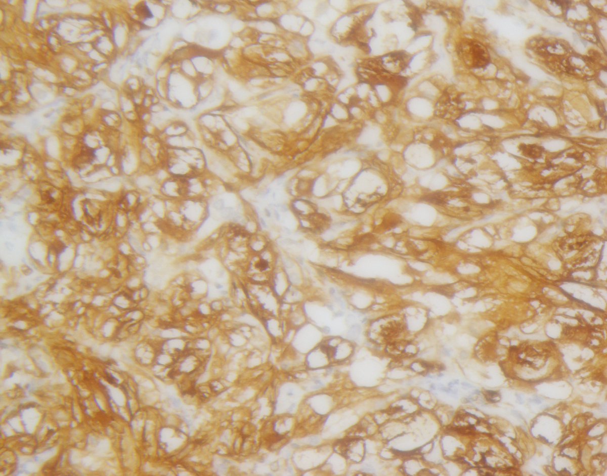 Anthony J Gill tweet media