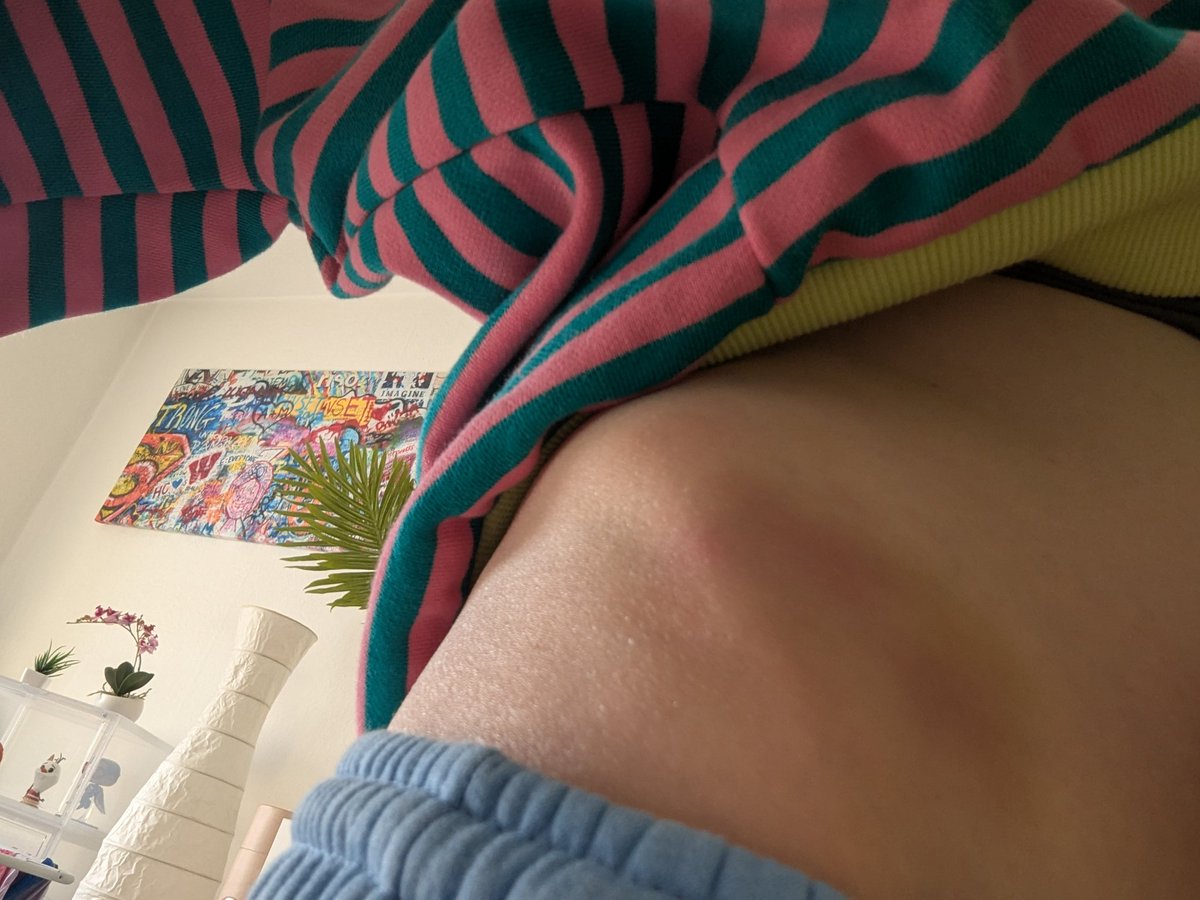 Jennystandhaft2's tweet photo. Ich habe ein neues Hobby damit Schilder halten in Zukunft Unterhaltungswert hat, leider gehören blaue Flecken dazu.
#hulla https://t.co/kxkJfecJJ6