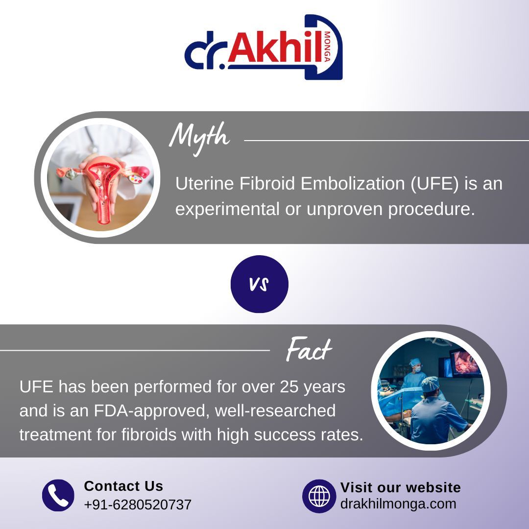 UFE has been performed for 25+ years, is FDA-approved, and has high success rates! It’s a safe, non-surgical option for fibroid treatment.

Know more: 🌐 drakhilmonga.com
📞 Contact us: +91-6280520737

#UFE #FibroidTreatment #WomensHealth #MinimallyInvasive