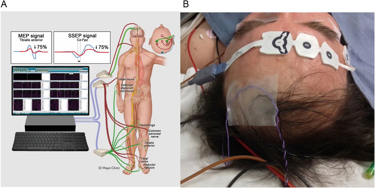 CVIR_Journal's tweet photo. #tb to 2023! 🔙
Thermoprotection of Neural Structures During Musculoskeletal Ablation
https://t.co/8M6vqtwpjk https://t.co/1x9PZzQpQ3