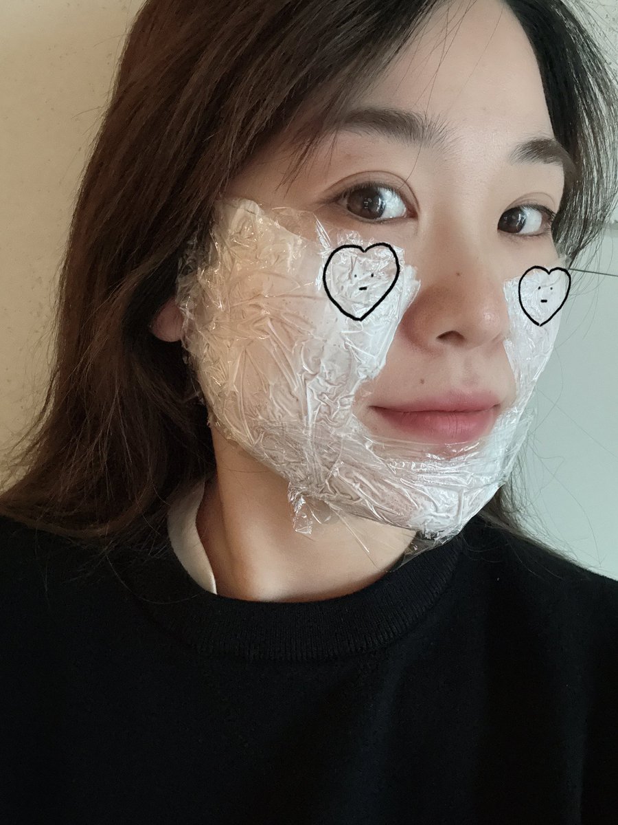 minv0315's tweet image. 昨日、toxnfill江南本店に行ってきたぁ〜！
皆さん丁寧な対応してくれて授乳中でも
出来るチタニウムリフトでパパ譲りのエラを撃退してきた❤️‍🔥ほうれい線も気になるかそこも🫶ダウンタイムも無くて即効性あるみたいやけど確かにほっそりした！
ほうれい線も薄くなってる🫧嬉しい〜

#PR #toxnfill