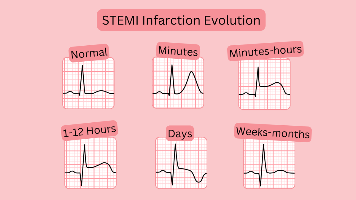 ECGsmart tweet media