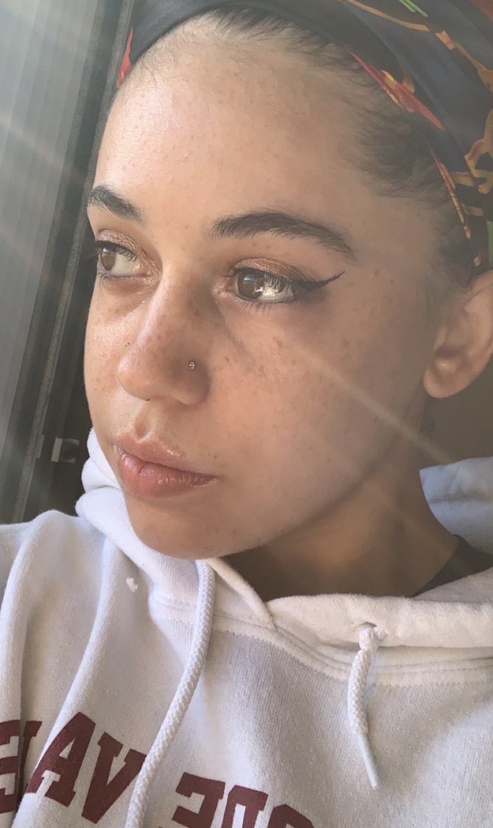 🩷 my freckles