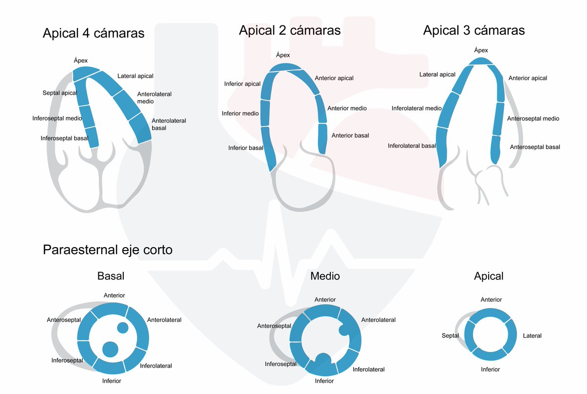 CardioNotion's tweet image. Segmentos miocárdicos por ecocardiografía 👇

#CardioNotion