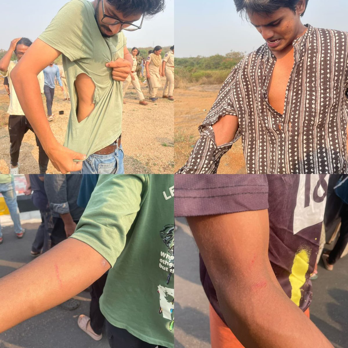 AnsarSonde's tweet photo. Is this PRAJA PALANA .
to make LOOTI , using LAATI as a form of force on raising voice. 
Questioning for injustice won't stop . 
ప్రజల పాలన లో , లూఠీ ని  ప్రశ్నించే వాడిని లాఠీ తో జవాబు చెప్తారా ... 
@RahulGandhi @narendramodi
@AmitShah @dhruv_rathee
#SaveKanchaForest
#uoh
#HCU https://t.co/0UlflSR16F