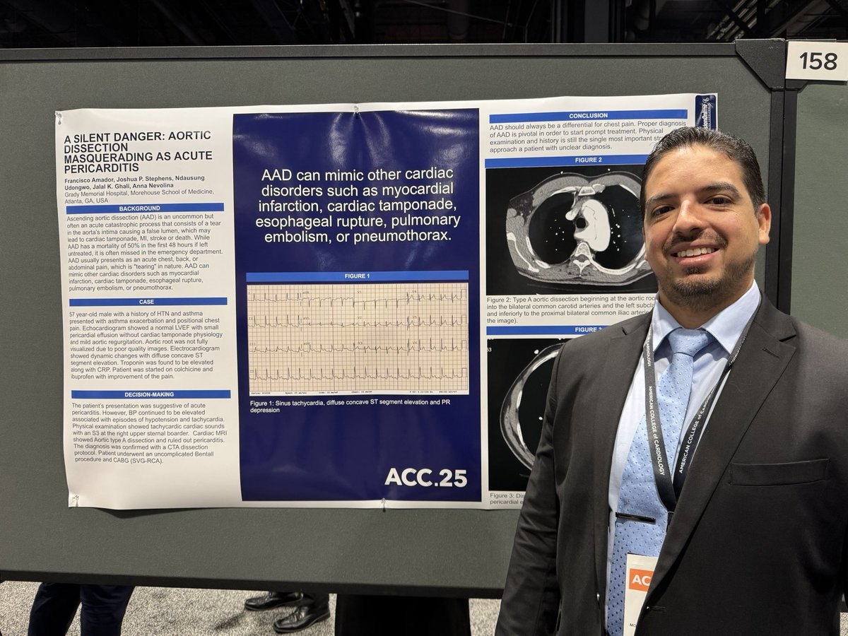 David X Zhuo, MD, FACC, FHFSA (@davidxzhuomd) on Twitter photo Congratulations to our <a href="/MSMEDU/">Morehouse School of Medicine</a> Cardiology fellow, Dr. Francisco Amador (<a href="/fjamadorc/">Francisco J. Amador, MD</a>), on his #ACC25 poster presenting a case of aortic dissection masquerading as acute pericarditis. A reminder to follow clinical intuition when things don’t quite add up. <a href="/ACCinTouch/">American College of Cardiology</a> <a href="/GradyHealth/">GradyHealth</a> Congratulations to our <a href="/MSMEDU/">Morehouse School of Medicine</a> Cardiology fellow, Dr. Francisco Amador (<a href="/fjamadorc/">Francisco J. Amador, MD</a>), on his #ACC25 poster presenting a case of aortic dissection masquerading as acute pericarditis. A reminder to follow clinical intuition when things don’t quite add up. <a href="/ACCinTouch/">American College of Cardiology</a> <a href="/GradyHealth/">GradyHealth</a>