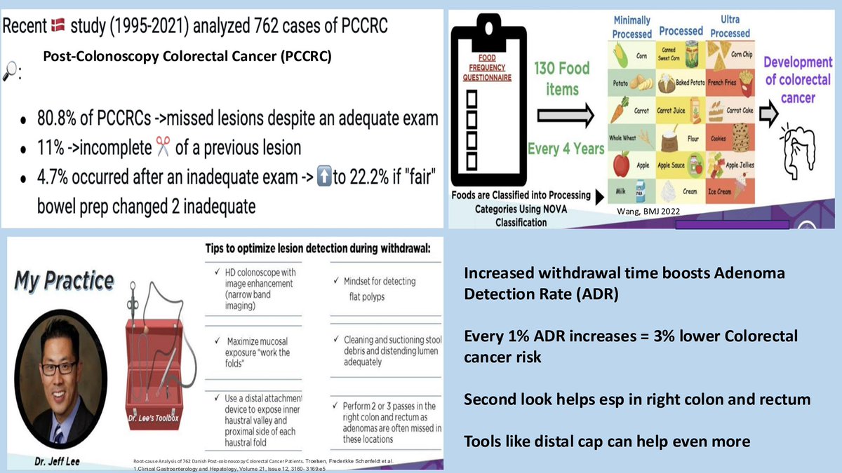 #ScopingSundays (@scopingsundays) on Twitter photo Missed out on the 🔥🔥 #ScopingSundays & <a href="/ACG_EBGI/">Evidence-Based GI: An ACG Publication (EBGI)</a> collab session past weekend on “#CRCPrevention - From Screening to Resection”
Check out the #ScopingSummary of the discussion by <a href="/BilalMohammadMD/">Mohammad Bilal, MD</a> , <a href="/umer446/">Umer Farooq</a> & <a href="/RomyChamoun/">Romy Chamoun, MD</a>
Special 🙏 <a href="/ceomaliko1/">Chidi E. Omaliko</a> to for the summary Missed out on the 🔥🔥 #ScopingSundays & <a href="/ACG_EBGI/">Evidence-Based GI: An ACG Publication (EBGI)</a> collab session past weekend on “#CRCPrevention - From Screening to Resection”
Check out the #ScopingSummary of the discussion by <a href="/BilalMohammadMD/">Mohammad Bilal, MD</a> , <a href="/umer446/">Umer Farooq</a> & <a href="/RomyChamoun/">Romy Chamoun, MD</a>
Special 🙏 <a href="/ceomaliko1/">Chidi E. Omaliko</a> to for the summary