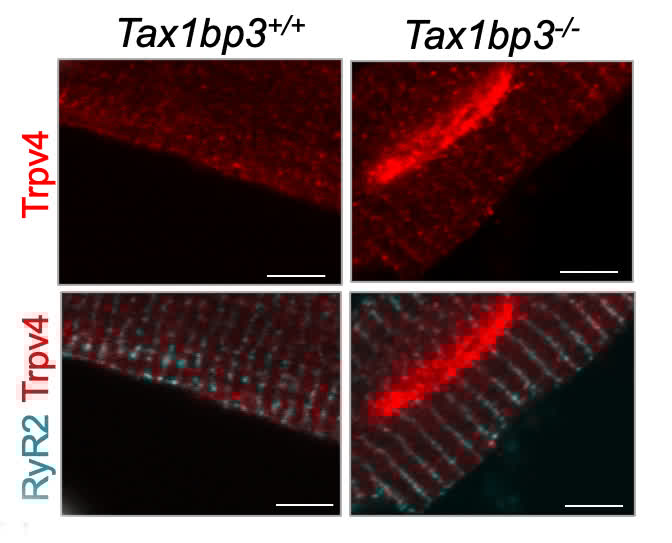 Perelli et al found that #TAX1BP3 is associated with a rare autosomal recessive #ACM through TRPV4-mediated Ca2+ leak from #RyR2. Learn more about a new therapeutic target for ACM at ahajrnls.org/3G1gy8k

@APLandstrom @Campbell_Mjay <a href="/PaulTangMD/">Paul C. Tang</a> <a href="/mary_moyamendez/">Mary Moya-Mendez</a>