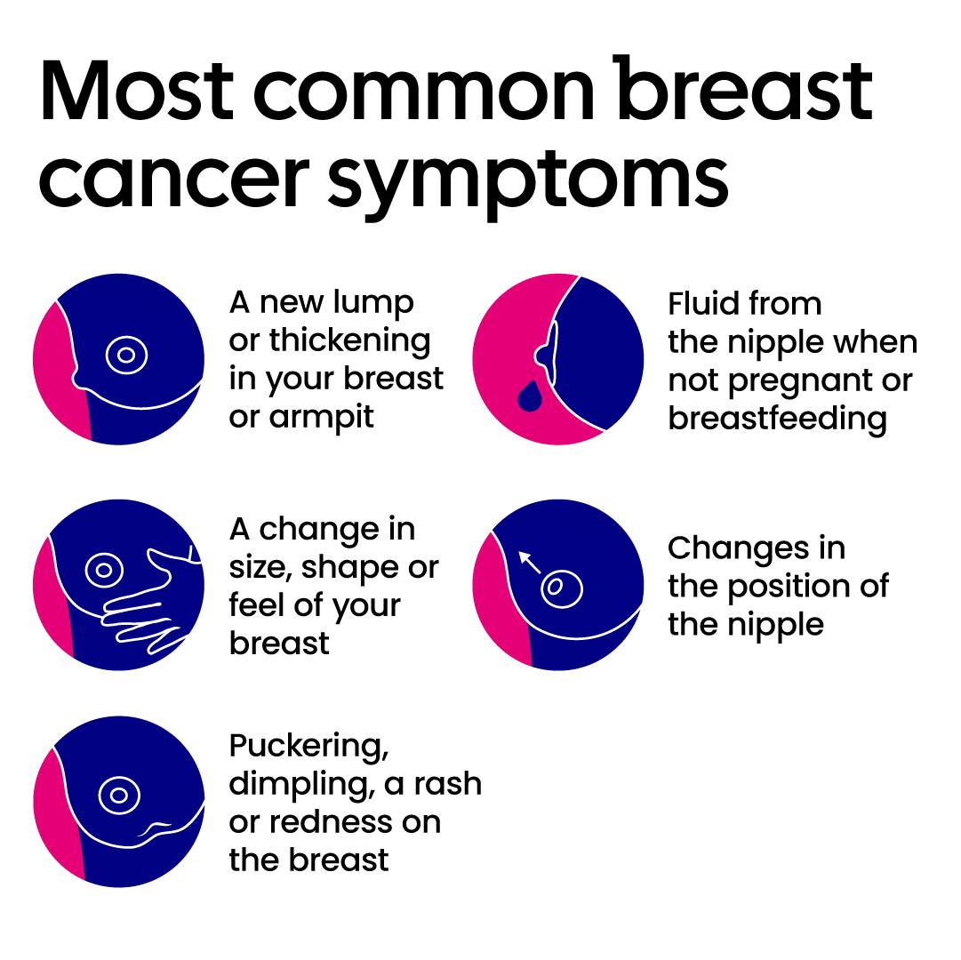 Stand Up To Cancer UK (@su2cuk) on Twitter photo Well, Sophie's choux buns have got us thinking - do you know the most common breast cancer symptoms? <a href="/CR_UK/">Cancer Research UK</a> have the important deets 🗣
The first symptom of breast cancer most people notice is a lump in their breast or some thickening.
Remember, if you notice anything unusual Well, Sophie's choux buns have got us thinking - do you know the most common breast cancer symptoms? <a href="/CR_UK/">Cancer Research UK</a> have the important deets 🗣
The first symptom of breast cancer most people notice is a lump in their breast or some thickening.
Remember, if you notice anything unusual