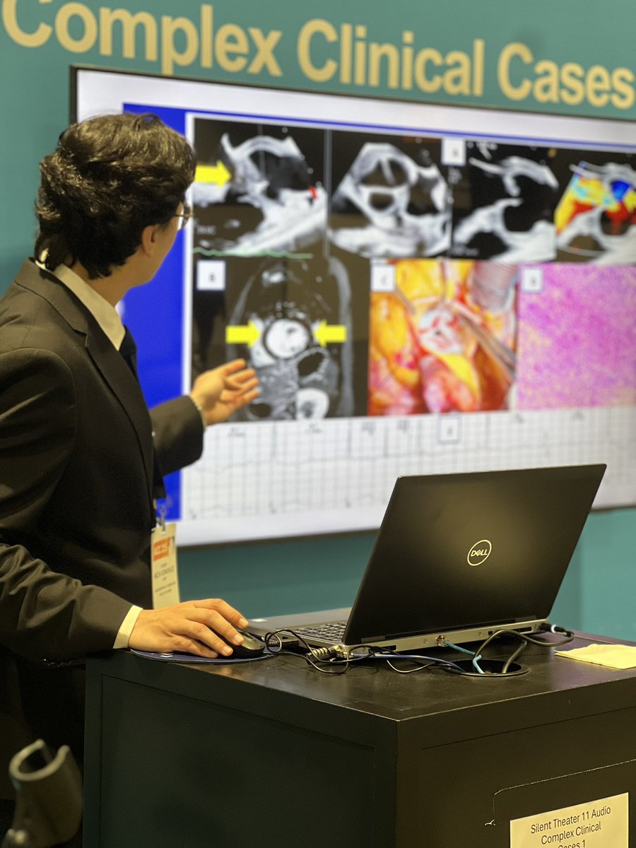 Yilmar A. Meza Gonzalez (@amezagonzalez) on Twitter photo A MULTIDISCIPLINARY APPROACH TO AN
UNUSUAL CARDIOVASCULAR
MANIFESTATION OF GRANULOMATOSIS
WITH POLYANGIITIS. 🫀
<a href="/ACCinTouch/">American College of Cardiology</a> #ACC25 #ACCAnywhere #ACCFIT A MULTIDISCIPLINARY APPROACH TO AN
UNUSUAL CARDIOVASCULAR
MANIFESTATION OF GRANULOMATOSIS
WITH POLYANGIITIS. 🫀
<a href="/ACCinTouch/">American College of Cardiology</a> #ACC25 #ACCAnywhere #ACCFIT