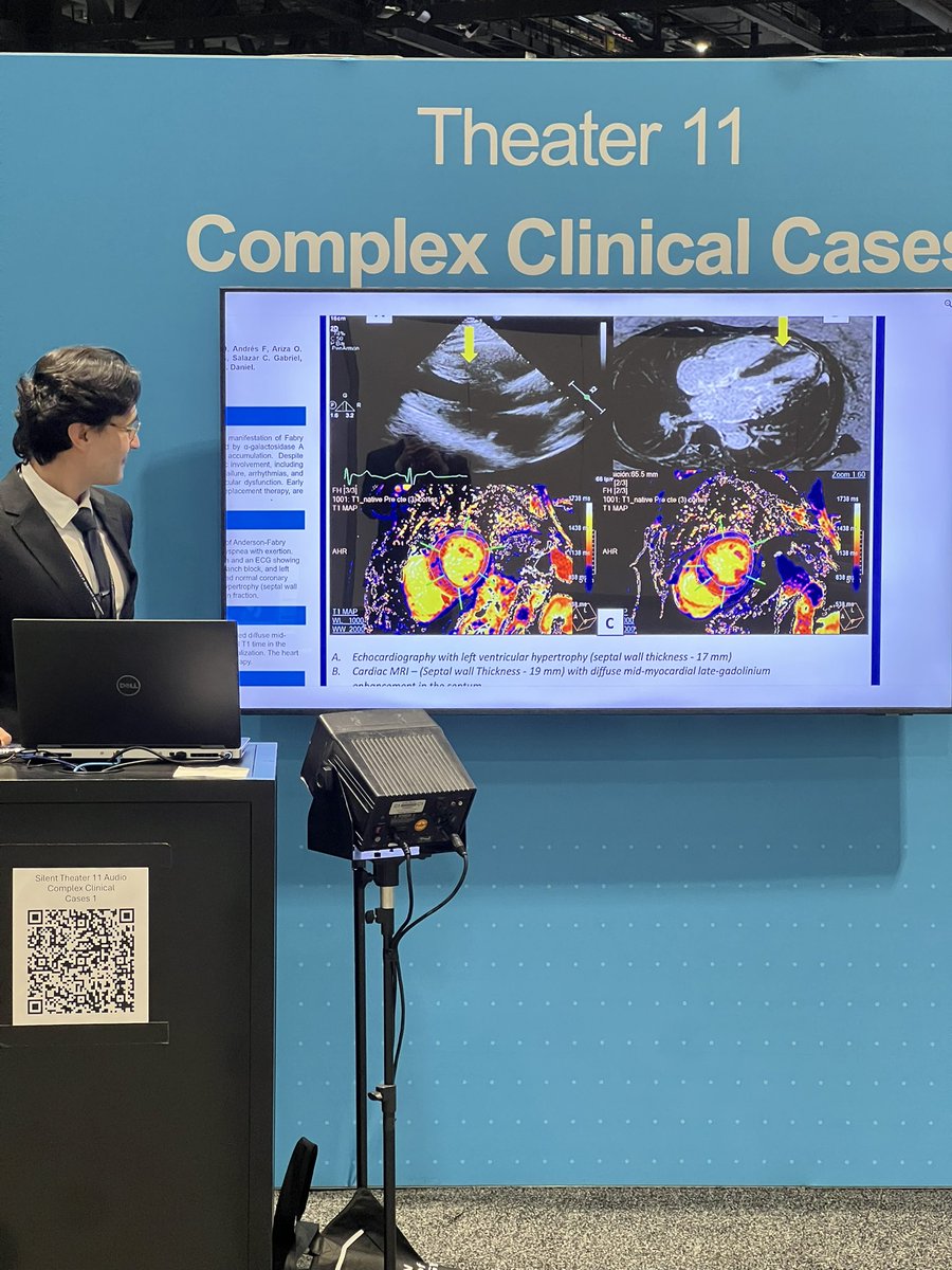 Yilmar A. Meza Gonzalez (@amezagonzalez) on Twitter photo UNSOLVING THE PUZZLE: ANDERSON-FABRY DISEASE IN AN ELDERLY WOMAN 🫀
<a href="/ACCinTouch/">American College of Cardiology</a> #ACC25 #ACCAnywhere #ACCFIT UNSOLVING THE PUZZLE: ANDERSON-FABRY DISEASE IN AN ELDERLY WOMAN 🫀
<a href="/ACCinTouch/">American College of Cardiology</a> #ACC25 #ACCAnywhere #ACCFIT