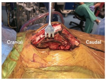 Artificial Organs (@artiforgans) on Twitter photo #Reoperative #LVAD Insertion Following Previous #CABG: Less Invasive Versus #Sternotomy Approach
👉tinyurl.com/bddc4sx4
<a href="/WMCHealth/">Westchester Medical Center Health Network</a> <a href="/SuguruOhira/">Suguru Ohira, MD, PhD</a> <a href="/guy_elgar/">Guy Elgar</a> #LessInvasive #Reoperative #LVAD Insertion Following Previous #CABG: Less Invasive Versus #Sternotomy Approach
👉tinyurl.com/bddc4sx4
<a href="/WMCHealth/">Westchester Medical Center Health Network</a> <a href="/SuguruOhira/">Suguru Ohira, MD, PhD</a> <a href="/guy_elgar/">Guy Elgar</a> #LessInvasive