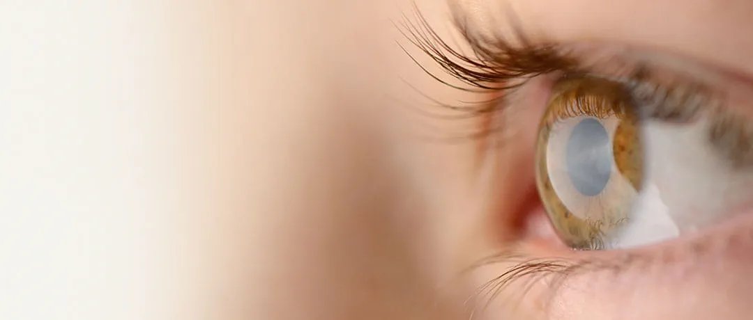 At our talk, 16 April, 7pm <a href="/AngliaRuskin/">ARU</a> we'll hear all about eye care. From prevention of diseases to cures Dr Piyasena from <a href="/veri_aru/">Vision and Eye Research Institute (VERI)</a> will tell us all!
Come along - IT'S FREE, All Welcome.
cses.org.uk/events
<a href="/ChelmsCouncil/">Chelmsford City Council</a> <a href="/ChelmsfordCVS/">Chelmsford CVS</a> <a href="/FHEMS_ARU/">Anglia Ruskin FHEMS</a> 
Please Re-Tweet To Help