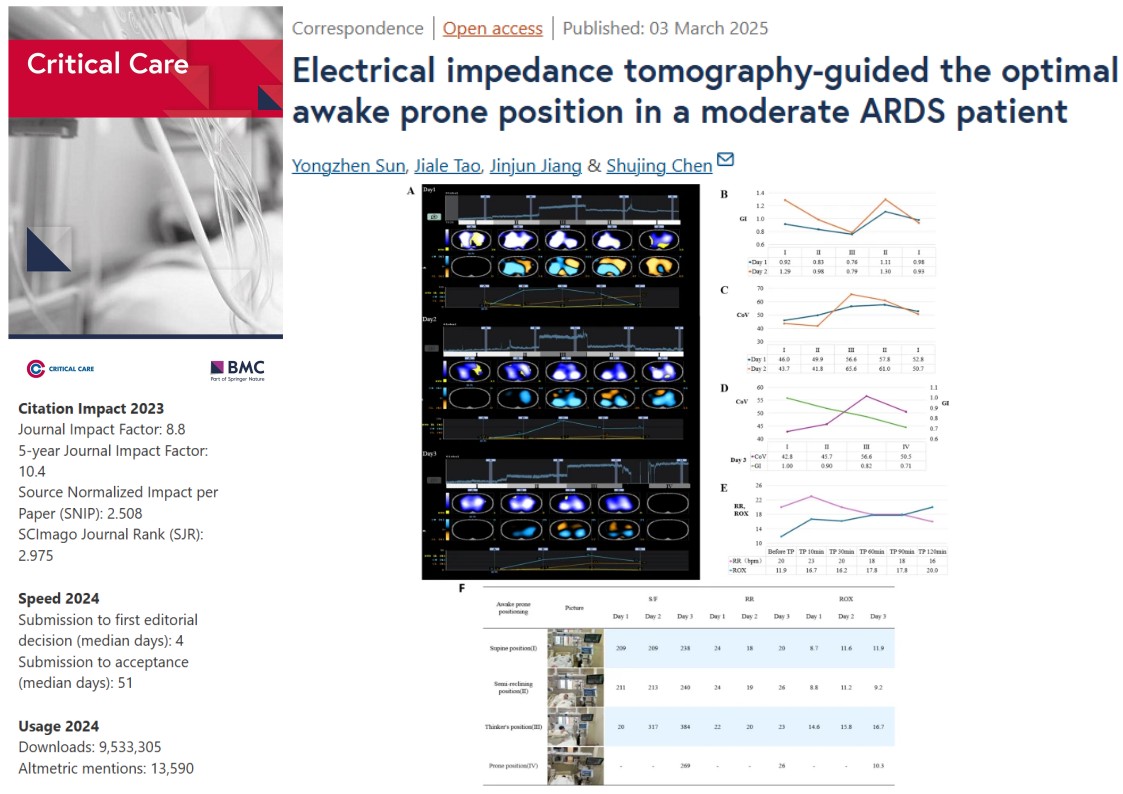 Critical Care (@crit_care) on Twitter photo #CritCare #OpenAccess               
Electrical impedance tomography-guided the optimal awake prone position in a moderate ARDS patient 
Read the full article: doi.org/10.1186/s13054…
<a href="/jlvincen/">Jean-Louis Vincent</a> <a href="/ISICEM/">ISICEM</a> #FOAMed #FOAMcc #CritCare #OpenAccess               
Electrical impedance tomography-guided the optimal awake prone position in a moderate ARDS patient 
Read the full article: doi.org/10.1186/s13054…
<a href="/jlvincen/">Jean-Louis Vincent</a> <a href="/ISICEM/">ISICEM</a> #FOAMed #FOAMcc