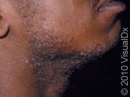 benmwine's tweet photo. LIFE HACK:
Dear men, if you have trouble with razor bumps after shaving, get some castor oil and apply it daily.
You'll come back to thank me in a few weeks.
And you'll never have that issue again, ever! https://t.co/3rNMwWUO12