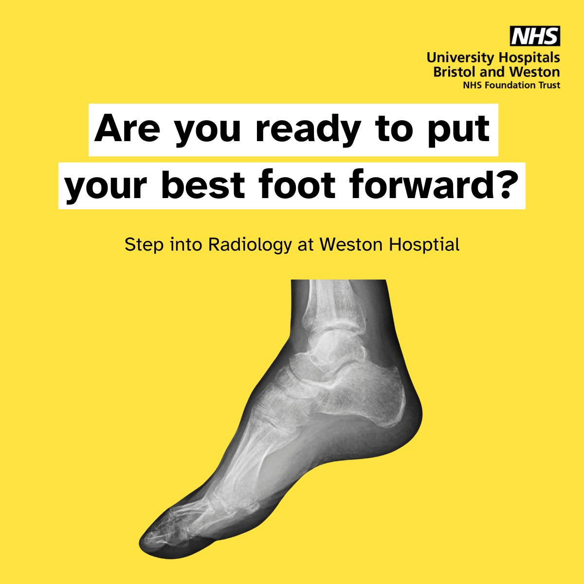 Join UHBW as a Radiography Assistant in Weston!

 ✅Support patients through their journey
 ✅Work with a skilled team
 ✅Gain valuable hands-on experience

Be quick! The vacancy closes on the 3rd of April
jobs.uhbristol.nhs.uk/job/v7094397

#HealthcareJobs #Radiology