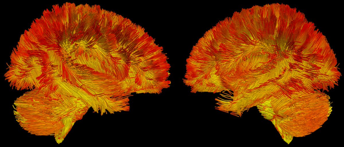 This is the first map of human brain mitochondria.

🧵1/11