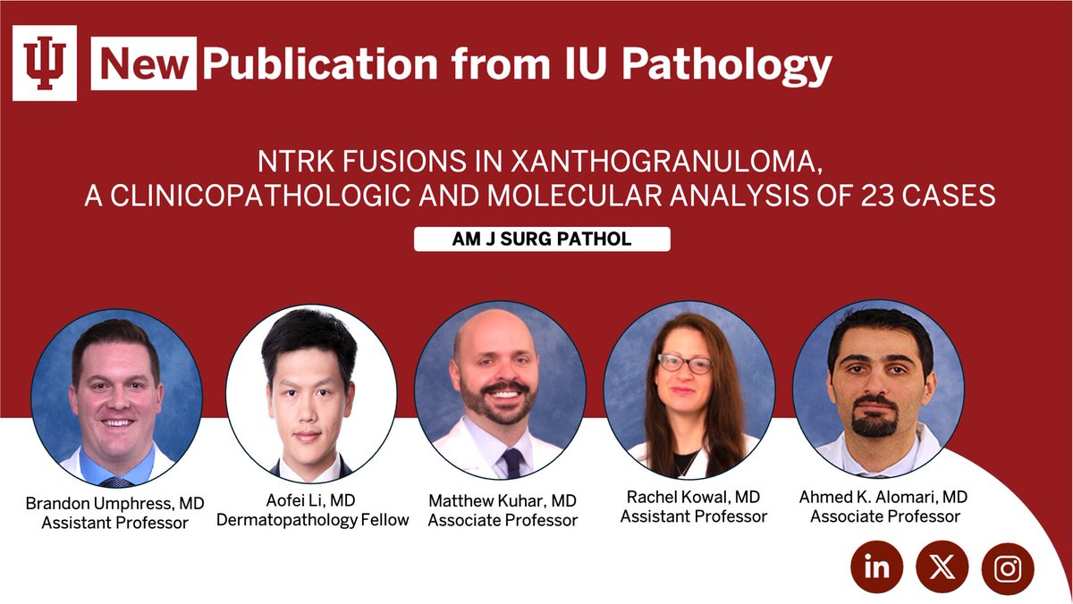 IUPathology (@iupathology) on Twitter photo 🆕 New publication alert 🚨
NTRK1 fusions are significantly more frequent in solitary xanthogranulomas than in disseminated cases. Pan-TRK IHC may aid diagnosis and risk stratification.
#dermpath <a href="/BUmphressMD/">Brandon Umphress, MD</a> <a href="/aofei_li/">aofei li</a> <a href="/AlomariDermpath/">Ahmed Alomari, MD</a> <a href="/AJSPjournal/">Surgical Pathology</a>
🔗 journals.lww.com/ajsp/abstract/… 🆕 New publication alert 🚨
NTRK1 fusions are significantly more frequent in solitary xanthogranulomas than in disseminated cases. Pan-TRK IHC may aid diagnosis and risk stratification.
#dermpath <a href="/BUmphressMD/">Brandon Umphress, MD</a> <a href="/aofei_li/">aofei li</a> <a href="/AlomariDermpath/">Ahmed Alomari, MD</a> <a href="/AJSPjournal/">Surgical Pathology</a>
🔗 journals.lww.com/ajsp/abstract/…