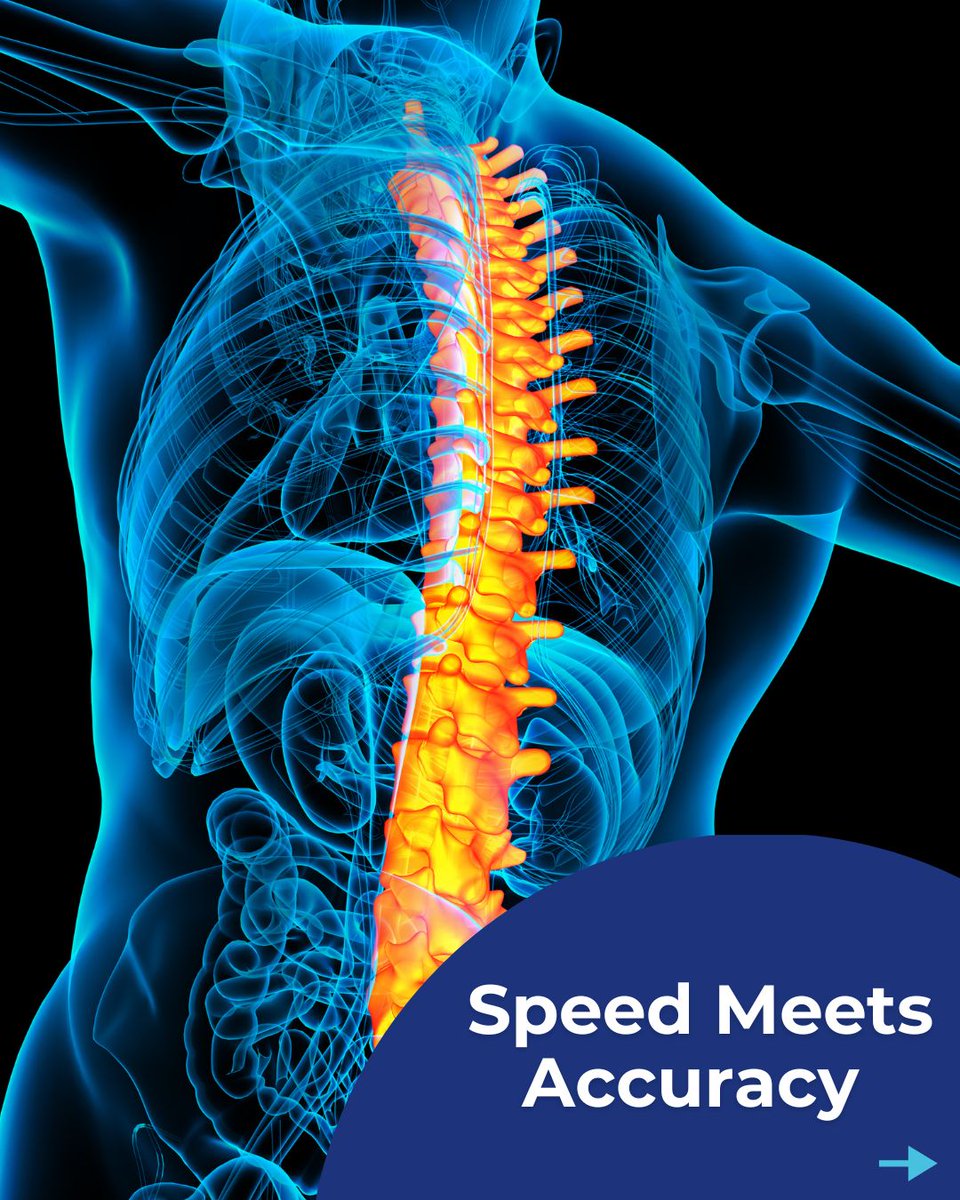 SpineCAMP's tweet photo. https://t.co/pIlQYHjYKa

The metrics produced by SpineCAMP™ are intended to be used to support qualified and licensed professional healthcare practitioners in clinical decision-making for skeletally mature patients of age 18 and above. https://t.co/akRFlicg8J