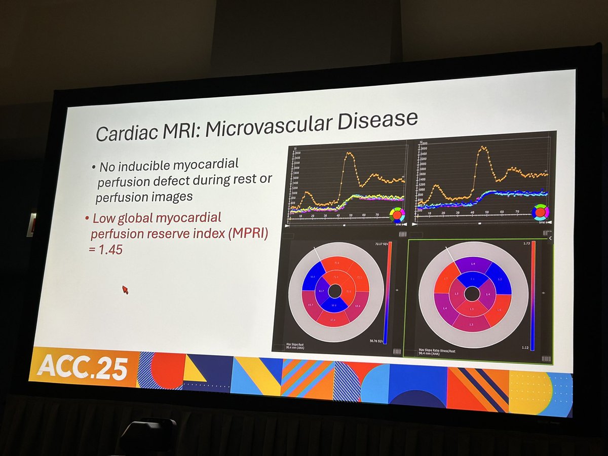 Ana Barac, MD, PhD, FACC, FAHA (@anabaraccardio) on Twitter photo New Era #CardioOnc Imaging #ACC2025!! Check great talk by Dr Zaha <a href="/vgzmd/">Vlad Zaha</a> on #EchoFirst #whyCMR as part of Survivorship Passport!
<a href="/Drdiptigupta1/">Dr dipti gupta</a> <a href="/md_addison/">Daniel Addison, MD</a> <a href="/datsunian/">Eric H Yang, MD</a> <a href="/vgzmd/">Vlad Zaha</a> <a href="/TomasNeilan/">Tomas G. Neilan, MD, MPH</a> <a href="/ACCinTouch/">American College of Cardiology</a> <a href="/JACCJournals/">JACC Journals</a> New Era #CardioOnc Imaging #ACC2025!! Check great talk by Dr Zaha <a href="/vgzmd/">Vlad Zaha</a> on #EchoFirst #whyCMR as part of Survivorship Passport!
<a href="/Drdiptigupta1/">Dr dipti gupta</a> <a href="/md_addison/">Daniel Addison, MD</a> <a href="/datsunian/">Eric H Yang, MD</a> <a href="/vgzmd/">Vlad Zaha</a> <a href="/TomasNeilan/">Tomas G. Neilan, MD, MPH</a> <a href="/ACCinTouch/">American College of Cardiology</a> <a href="/JACCJournals/">JACC Journals</a>