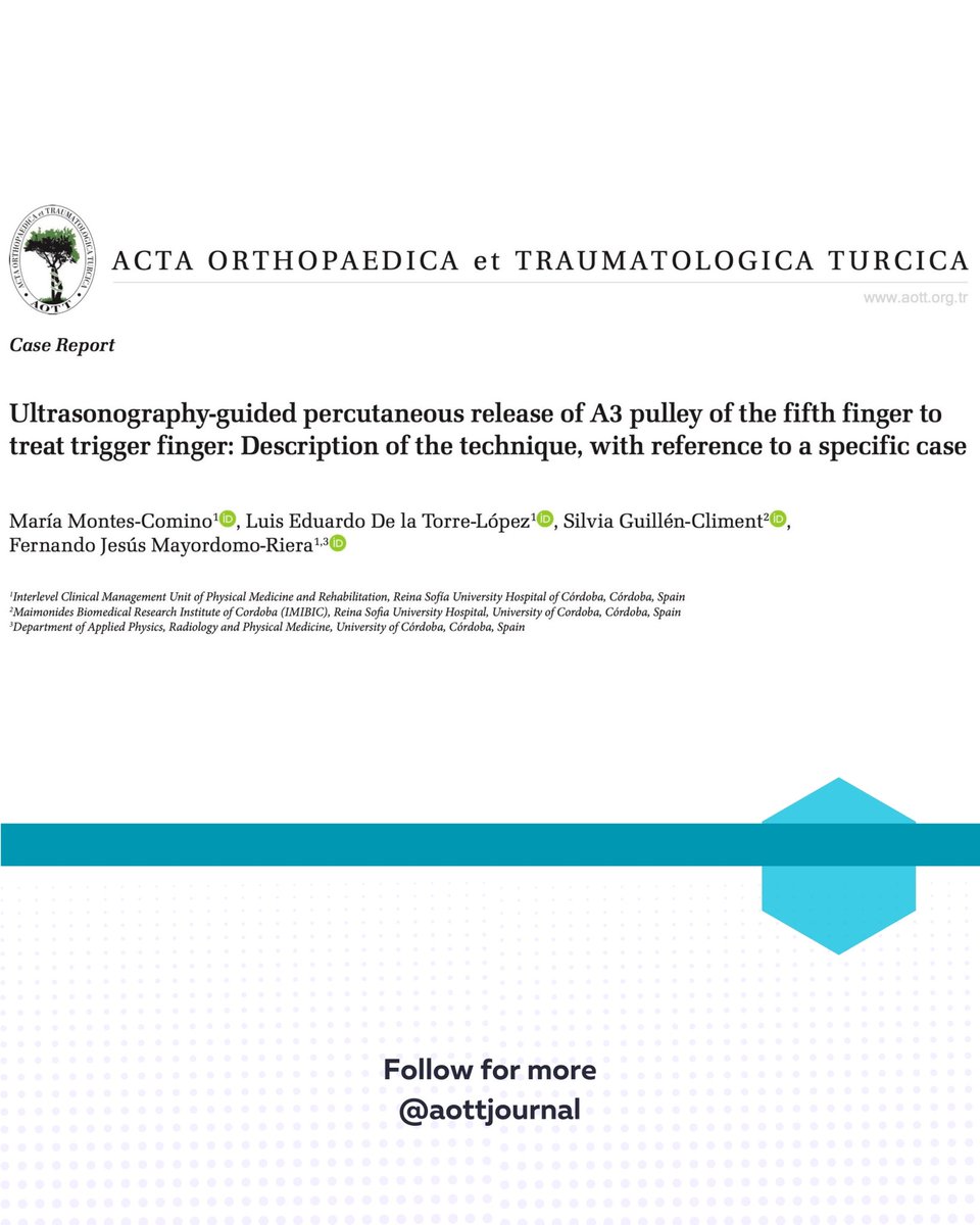 This case report introduces a pioneering application of a known technique: Ultrasonography-guided percutaneous release, performed for the first time on the A3 pulley of the fifth finger to treat trigger finger.
The successful outcome supports this less invasive approach as a