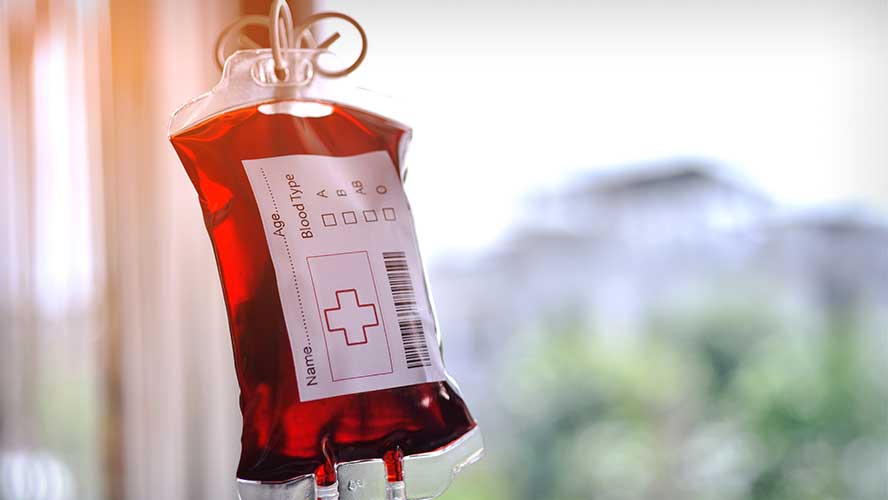 UHN Research (@uhn_research) on Twitter photo #NewPublication
Excessive bleeding is a risk in cardiac surgery.🫀 A new <a href="/TGHRI_UHN/">Toronto General Hospital Research Institute</a> study finds that prothrombin complex concentrate (PCC) is safer and more effective than frozen plasma at stopping bleeding.
Read more➡️ uhnresearch.ca/news/treating-… <a href="/OctapharmaGroup/">Octapharma</a> @JeannieCallum #NewPublication
Excessive bleeding is a risk in cardiac surgery.🫀 A new <a href="/TGHRI_UHN/">Toronto General Hospital Research Institute</a> study finds that prothrombin complex concentrate (PCC) is safer and more effective than frozen plasma at stopping bleeding.
Read more➡️ uhnresearch.ca/news/treating-… <a href="/OctapharmaGroup/">Octapharma</a> @JeannieCallum
