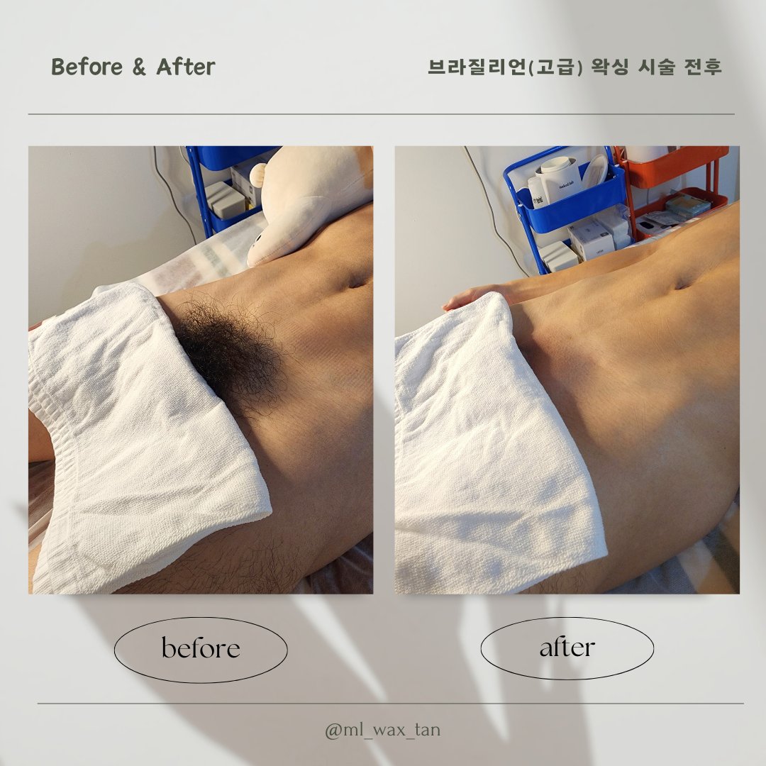 📍 위치
🚇 (2,5호선)까치산역 4번 출구 도보 4분
🅿️ 건물앞 주차가능
💠샤워실 완비
💠당일예약가능
💠1:1프라이빗 예약제
🕒 운영 시간
🔹연중 무휴 오후1시~밤12시 심야영업! _________________________
✅ 예약 방법 
💬 오픈카톡: open.kakao.com/o/sd8Qz6Kg

#남자왁서 #남자왁싱 #서울왁싱