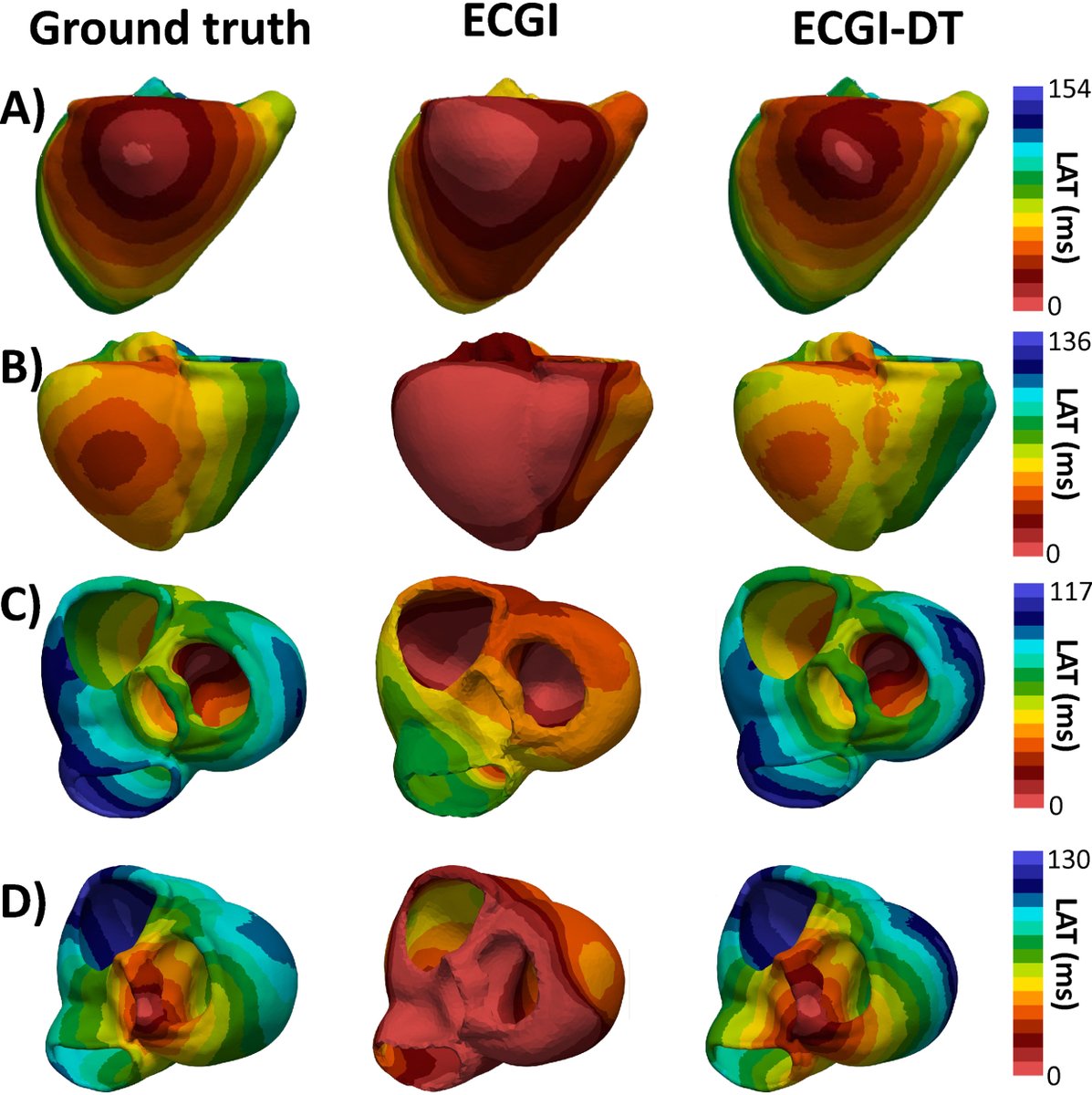❤🖱 Un gemelo digital del corazón ayuda a mejorar el diagnóstico y tratamientos de arritmias cardiacas f.mtr.cool/imrdtwluin

Ideada por el grupo COR-ITACA de la UPV, la nueva tecnología integra ECGI y permite reproducir la actividad eléctrica del miocardio de manera más fiel.