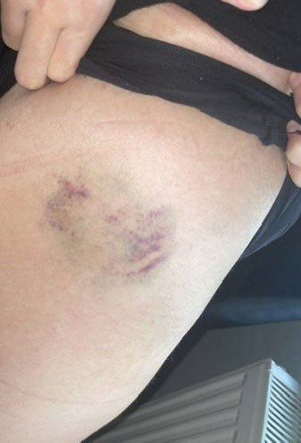 🔴İSTANBUL’DA UYUŞTURUCULU TECAVÜZ!

(Mağdurun ismini güvenlik nedeniyle farklı harflerle kodlayacağım. Adalet Bakanlığı yetkilileri konuya hakimdir)

İstanbul’da 21 yaşındaki üniversite öğrencisi M.K, kapı komşusu polis memurunun tecavüzüne uğradı, dava delil yetersizliğinden