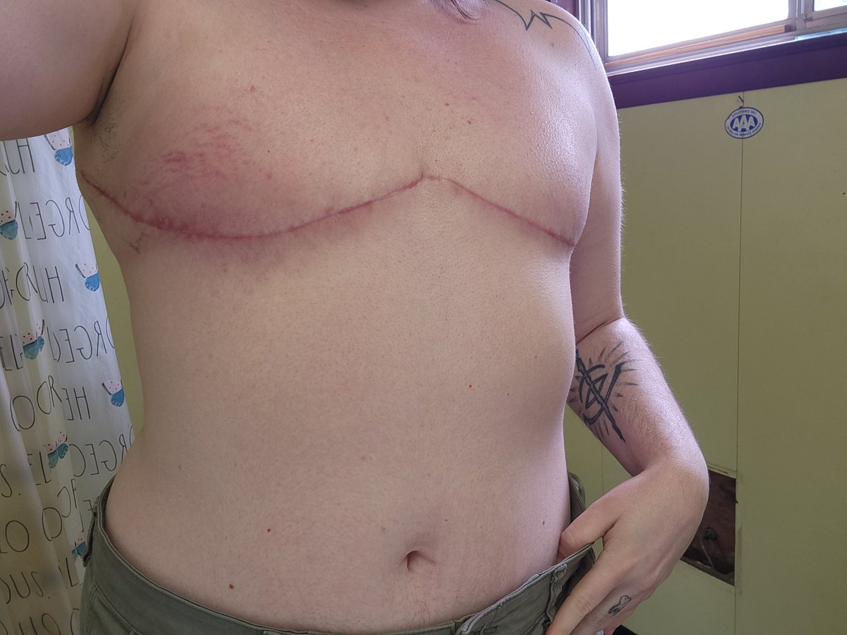 happy #TransDayOfVisibility im 6 weeks post op tomorrow 🏳️‍⚧️