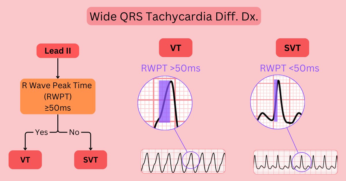 ECGsmart tweet media