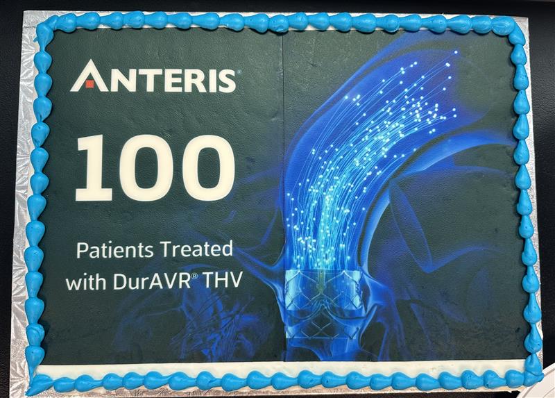 AnterisTech's tweet image. 🎉 100 patients milestone! We are extremely excited to announce that over 100 patients have now been treated with the DurAVR® Transcatheter Heart Valve (THV)! Each heart on our Heart Wall represents a patient who has been treated with DurAVR® THV. Every day our growing Heart Wall…