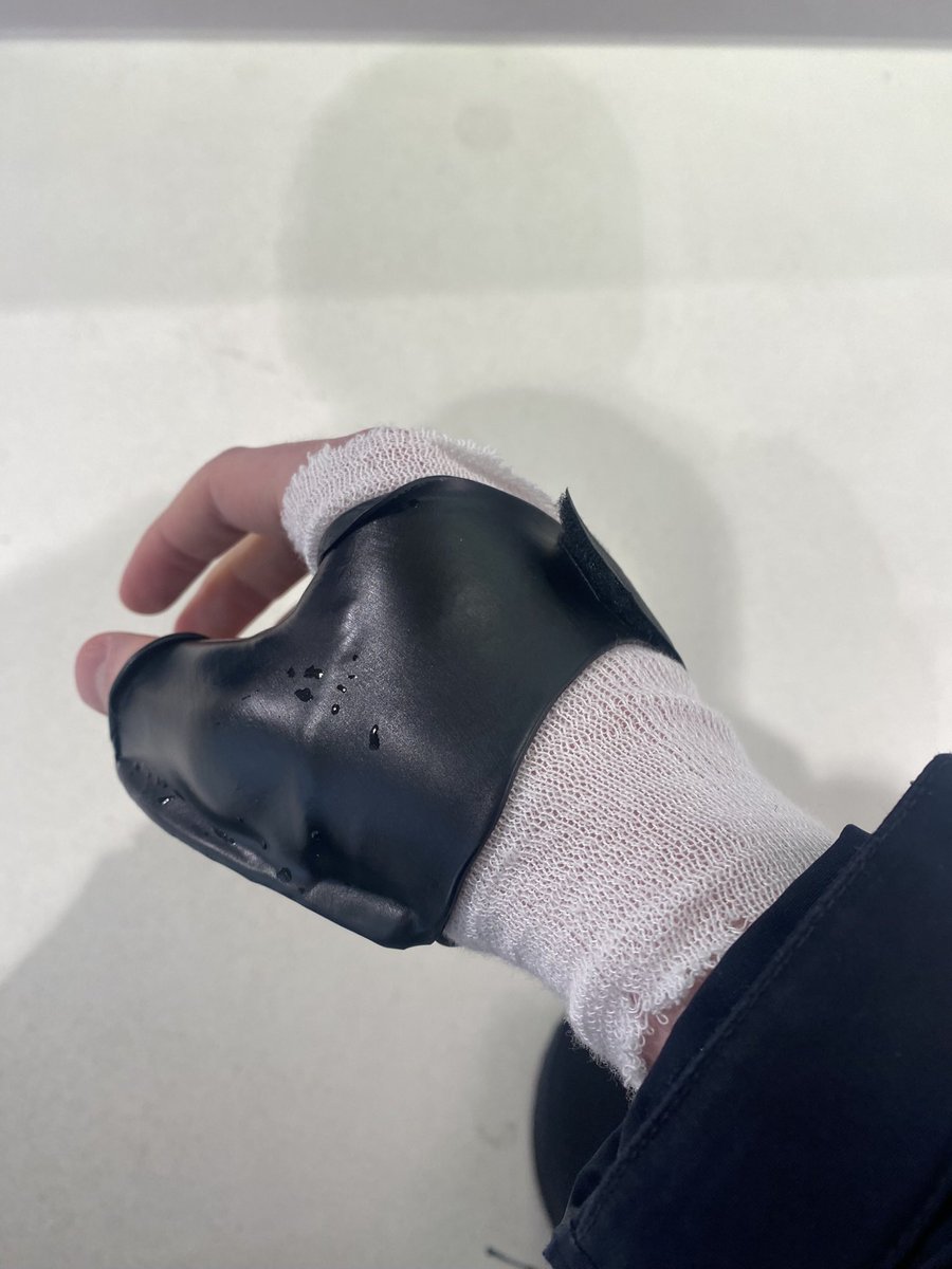 The downside to martial arts is the injuries.

Right hand demobilized for a few weeks.

Time to work on the jab👊🏼

We get it in regardless.
