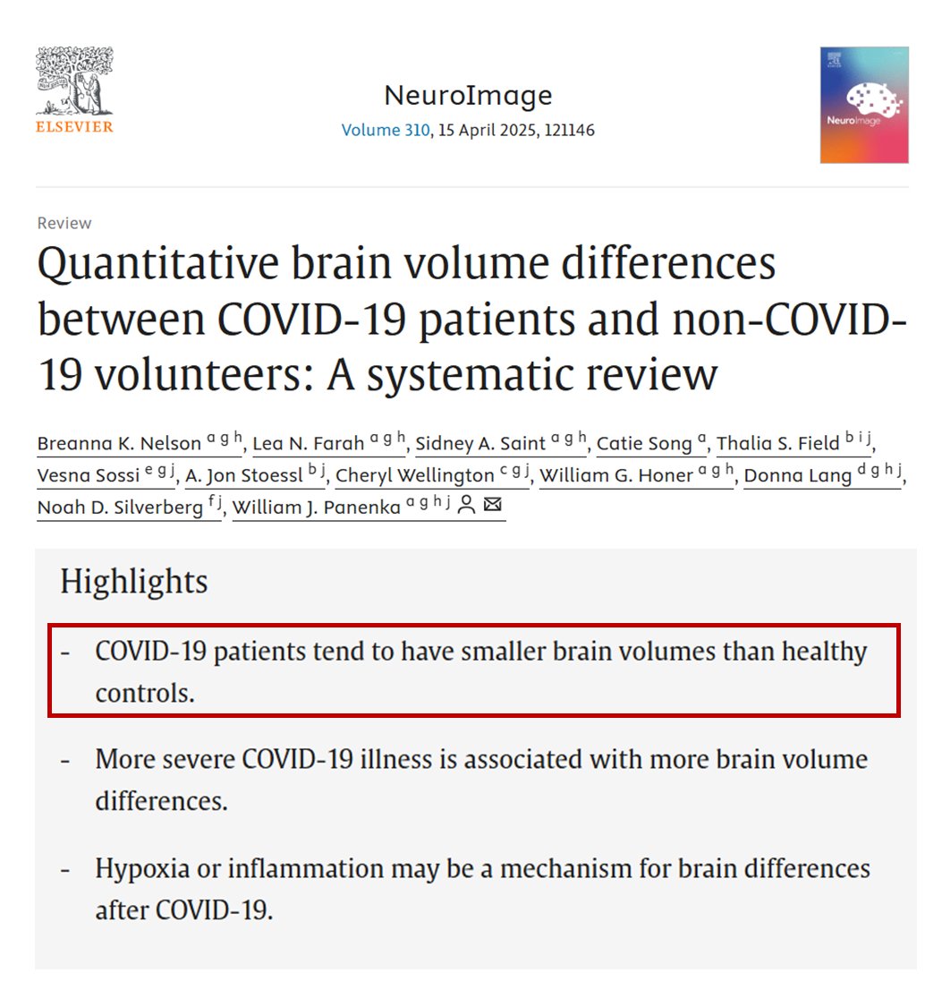 There's nothing to worry about; it's just that your brain is shrinking.  #NeuroCovid
sciencedirect.com/science/articl…