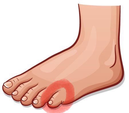 اكثر اصبع من اصابع القدم متعرض للصدمات وصكات وصابر وتحمل ومتعايش مع الاوضاع 🤪🏃‍♀️🏃‍♀️🏃‍♀️

#فضفضة