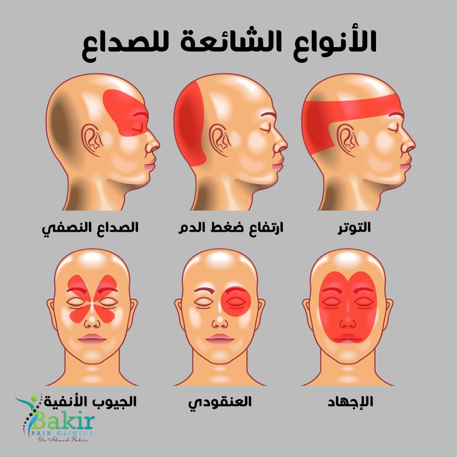 __88zr's tweet photo. انواع الصداع واسبابه والفرق بين الصداع النصفي الايمن والايسر ..وعلاج الصداع والصداع النصفي ..

فضلها وتابع السرد 🤍 https://t.co/FlykwB0khx