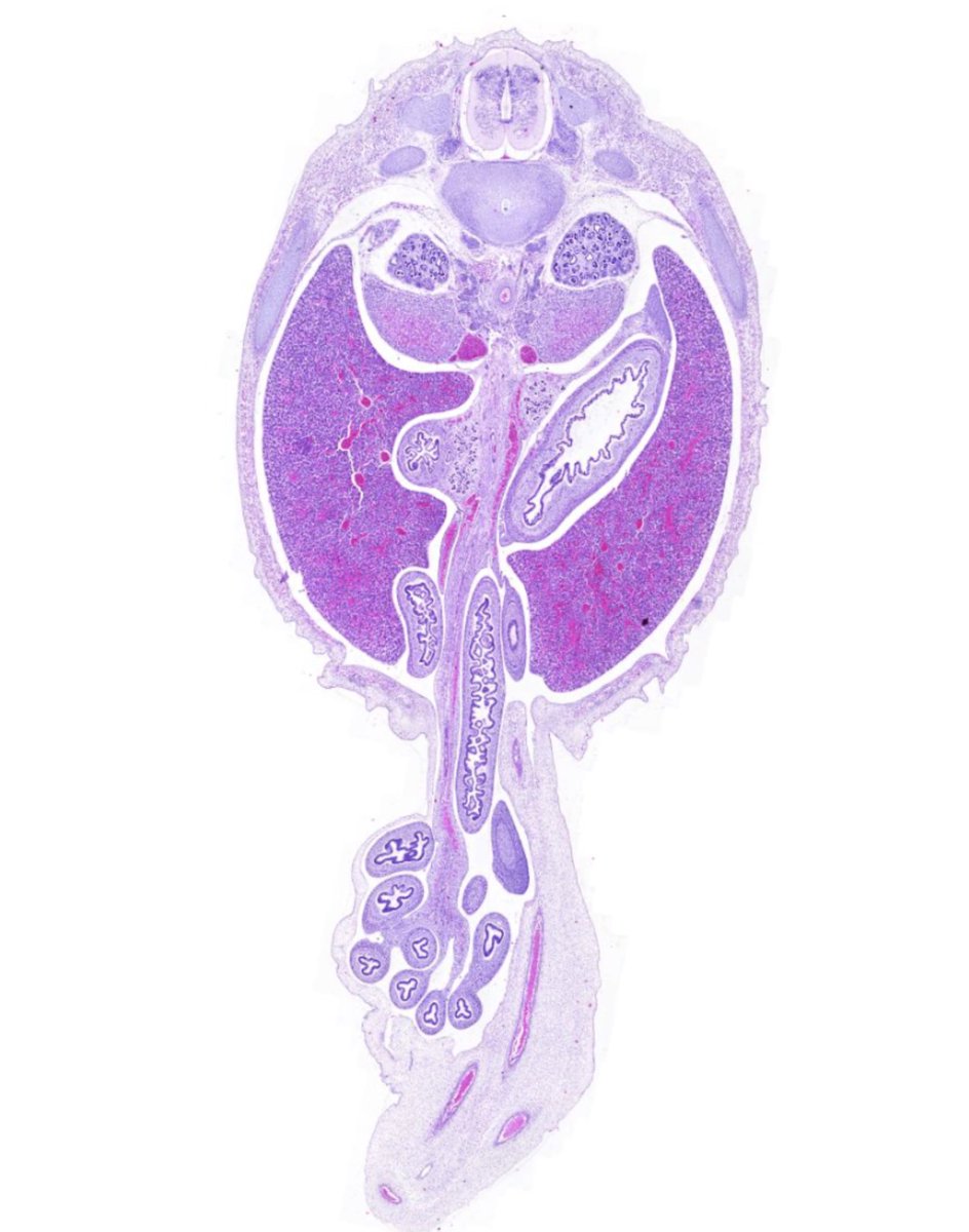 microscopio_v's tweet image. Dato loco del desarrollo: en la 6a semana el intestino crece tanto que sale temporalmente del abdomen hacia el cordón umbilical!
Es la hernia fisiológica, normalmente se resuelve en la 10a semana
La quieren ver? La tenemos en un nuevo preparado!
microscopiovirtual.fmed.edu.uy/c_d_embrion_fe…