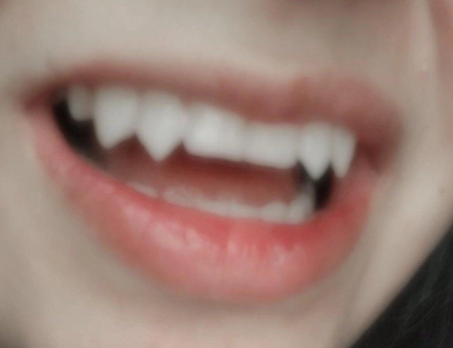 Torreliv03's tweet photo. Got permanent fangs. No it didn't hurt. I paid 50 for them and have to get used to them when eating too
#permanentfangs #bodymodification https://t.co/xoJyvWFV9L