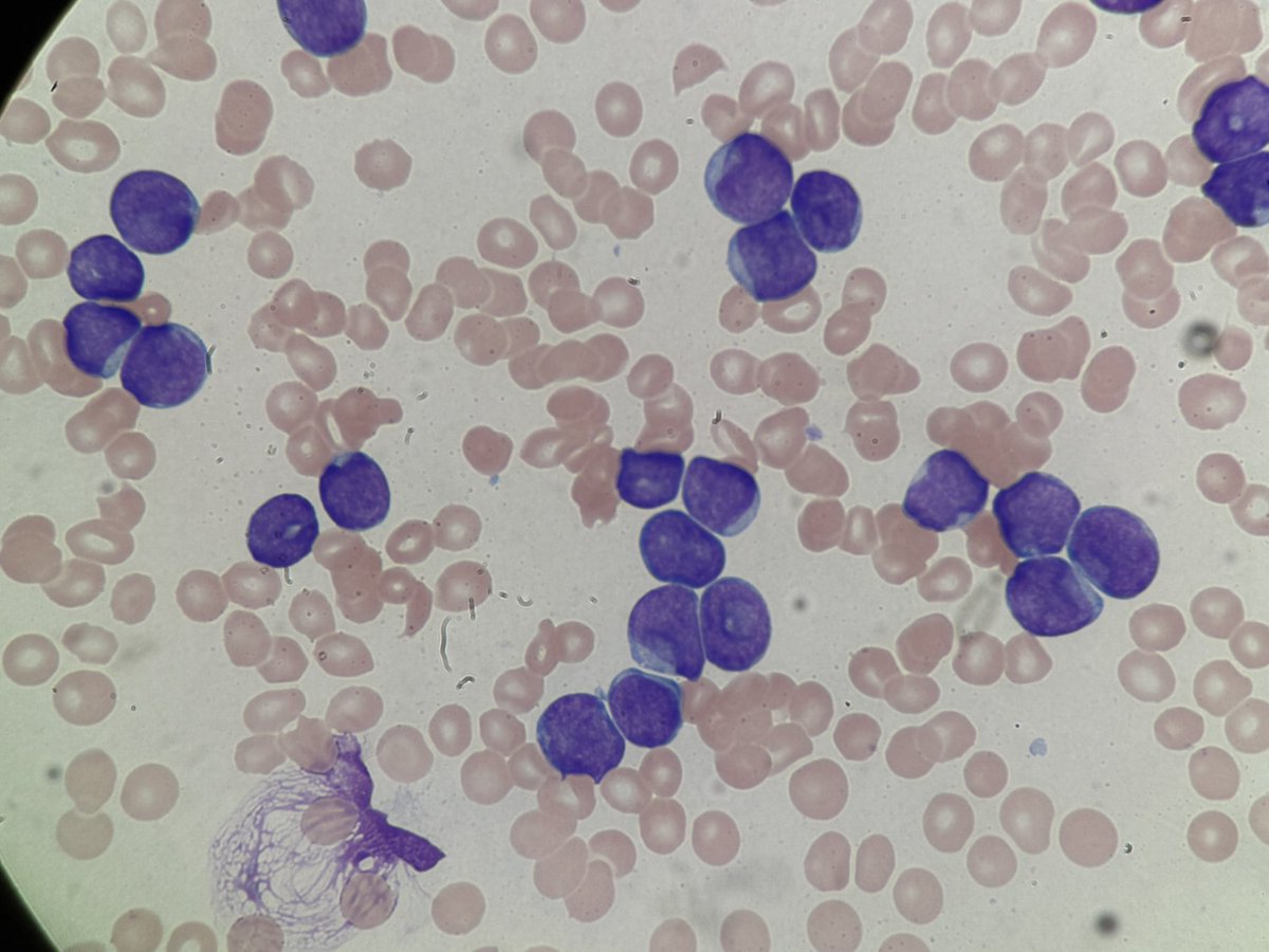 Diagnosis? Mutations?
#tooClosetoDiagnose